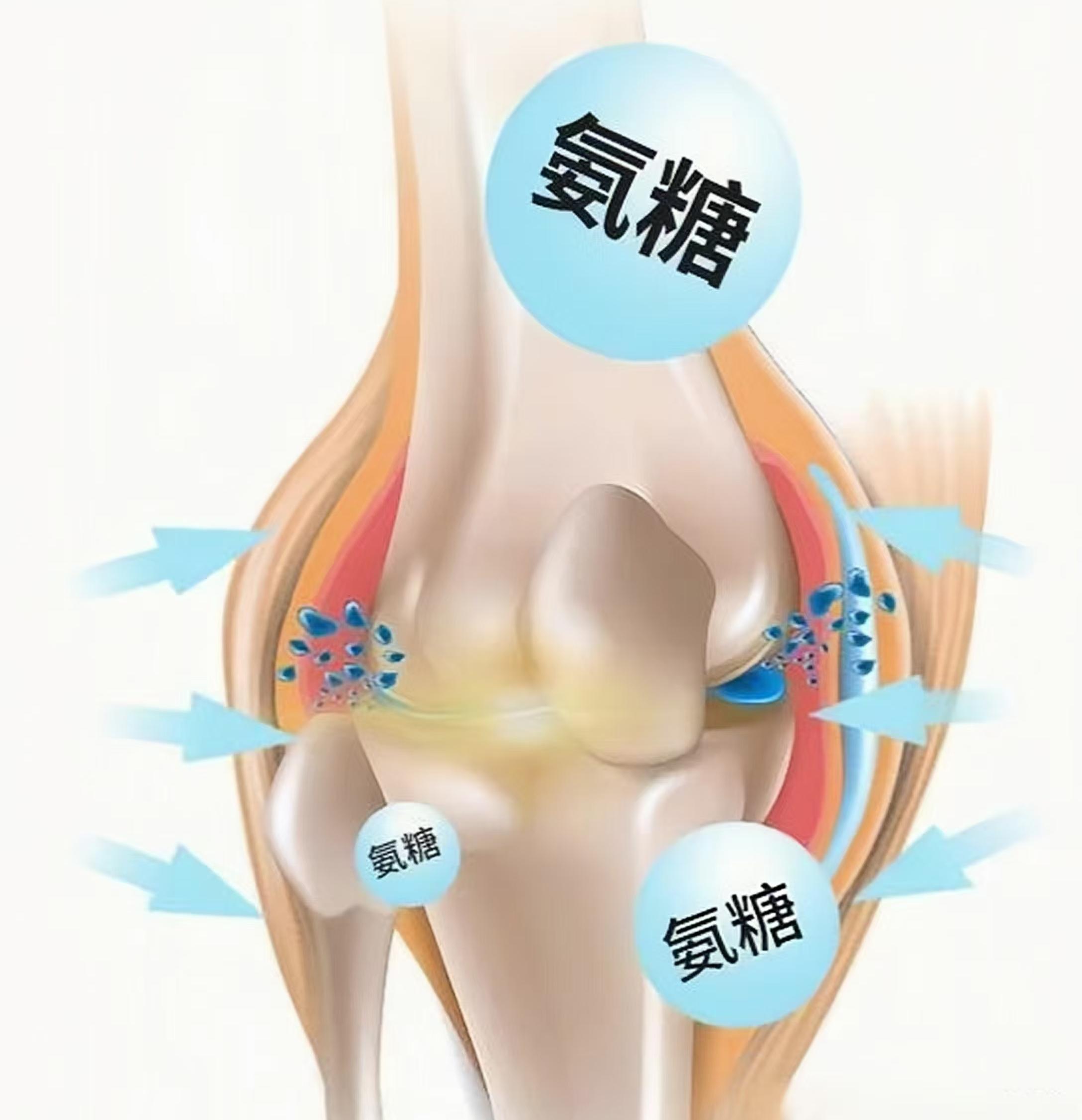 氨糖適合什么樣的人群補(bǔ)充？